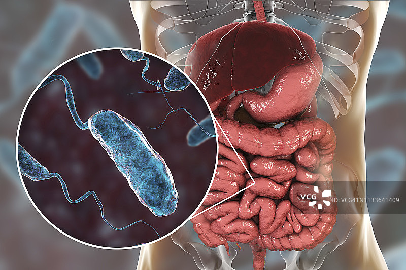 霍乱感染图示图片素材