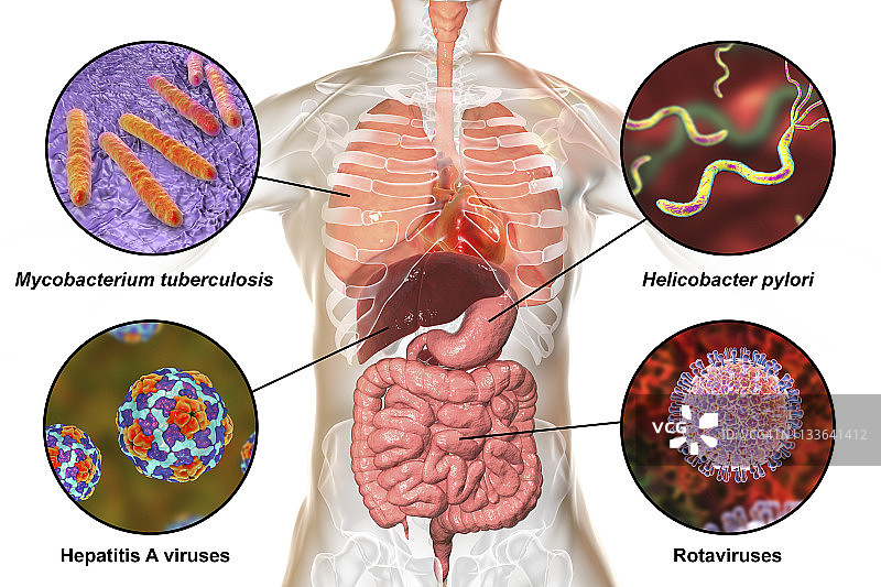 引起人类感染的细菌，图示图片素材