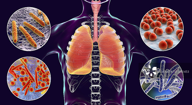 引起肺部感染的细菌图片素材
