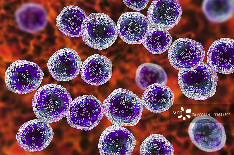 伯基特淋巴瘤细胞图图片素材