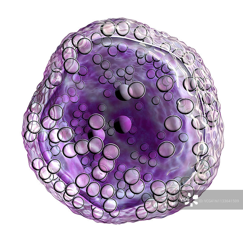 伯基特淋巴瘤细胞图图片素材