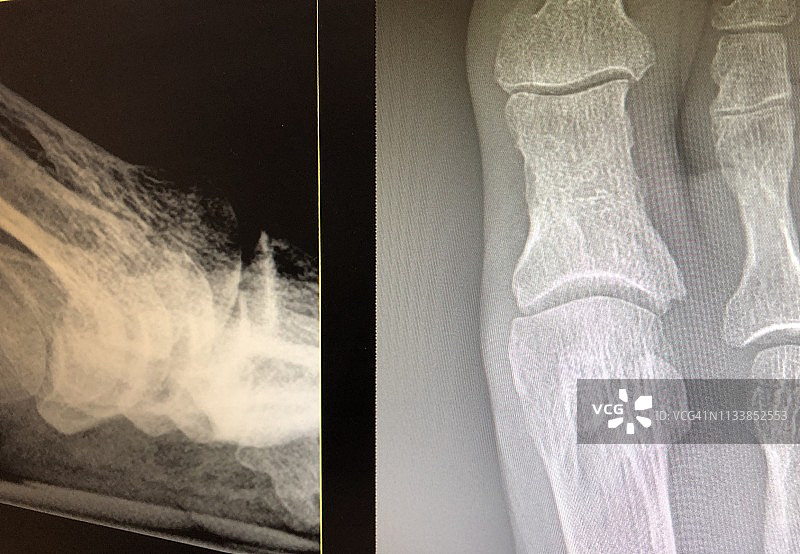 医生办公室检查台足病医生办公室图片素材