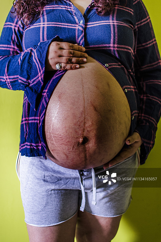 怀孕39周的成年女性腹部的妊娠纹图片素材