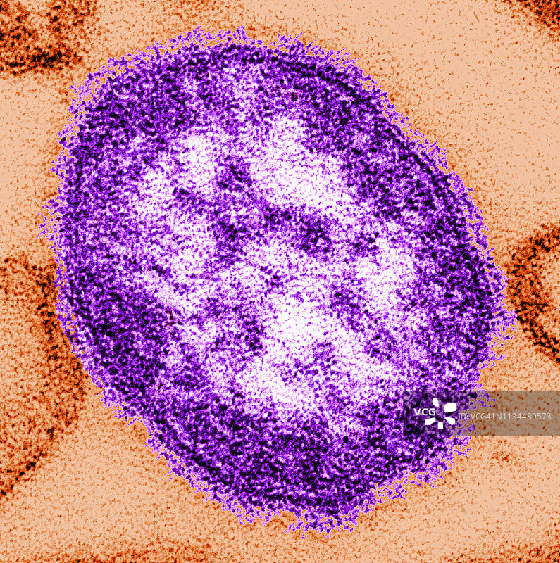 单个麻疹病毒颗粒或病毒体的透射电镜图像图片素材