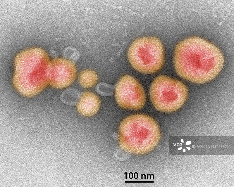 沙粒病毒的透射电镜图像图片素材