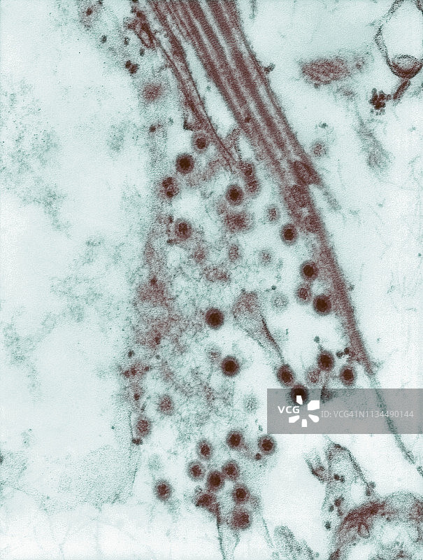 科罗拉多蜱热病毒（CTFV）的透射电子显微镜图像图片素材