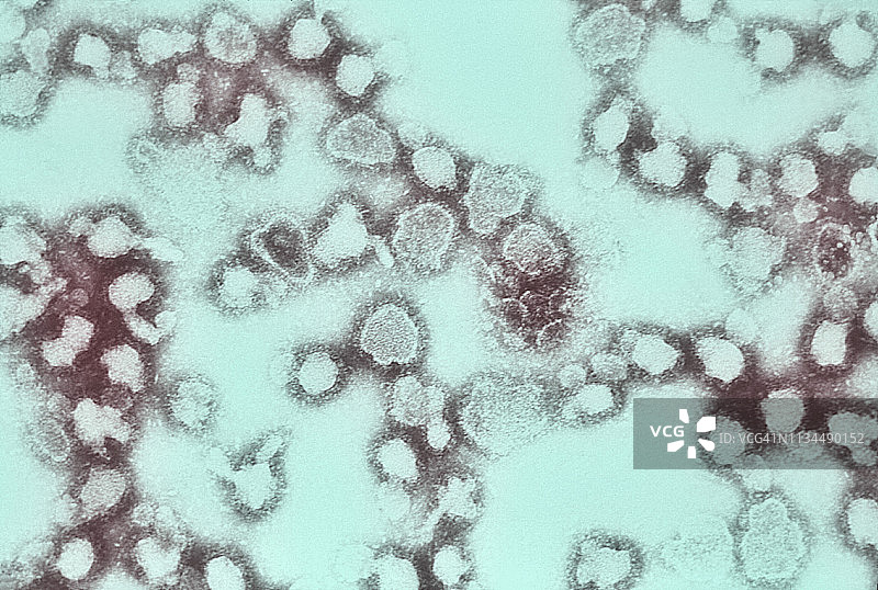 拉克罗斯脑炎病毒的透射电镜图像图片素材
