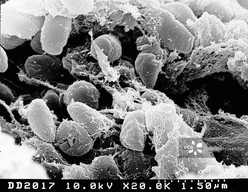 鼠疫细菌的SEM图像图片素材