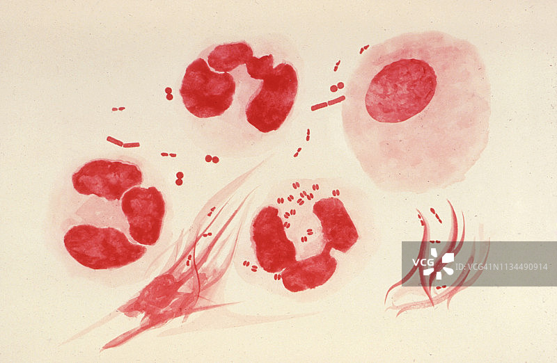 淋病奈瑟菌图片素材