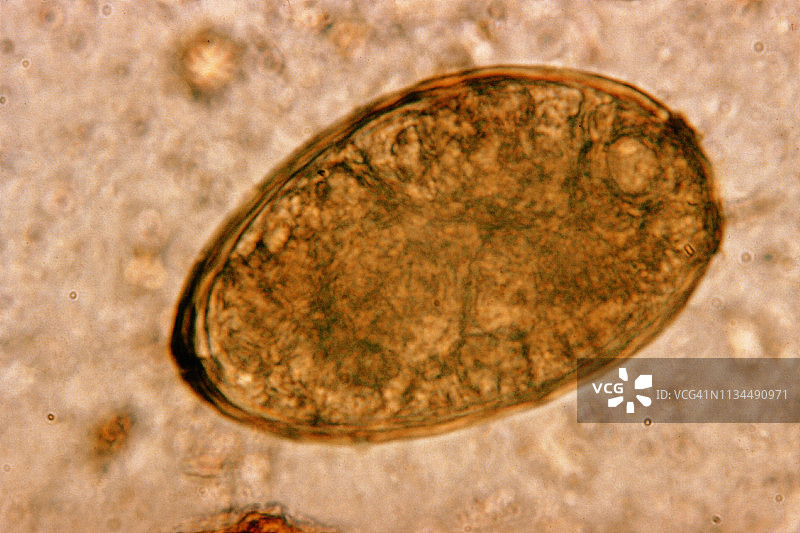显微照片：肺吸虫卵图片素材