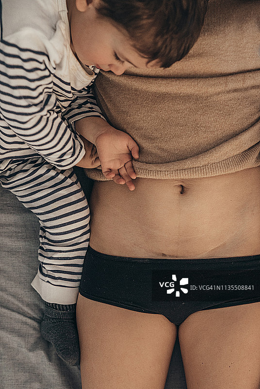 母亲向孩子展示剖腹产疤痕图片素材