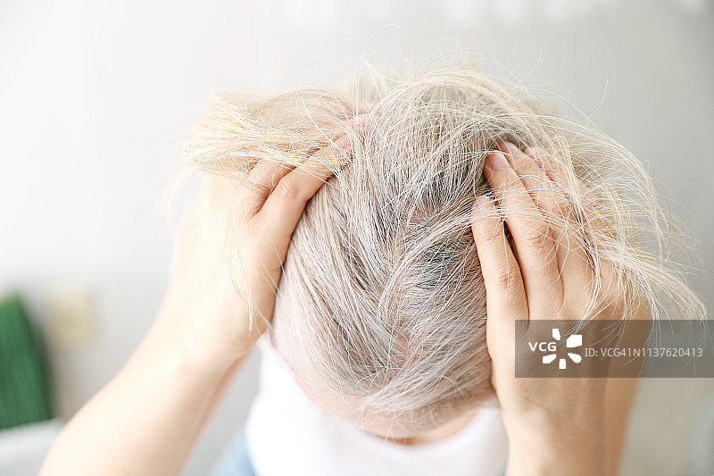脱发老年妇女特写图片素材