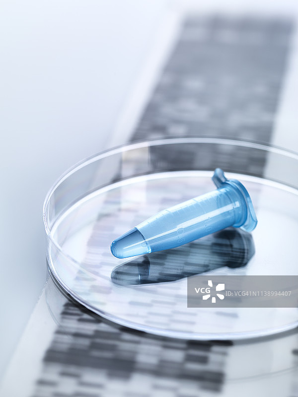 含有带DNA自显影结果的人体样本的Eppendorf试管图片素材