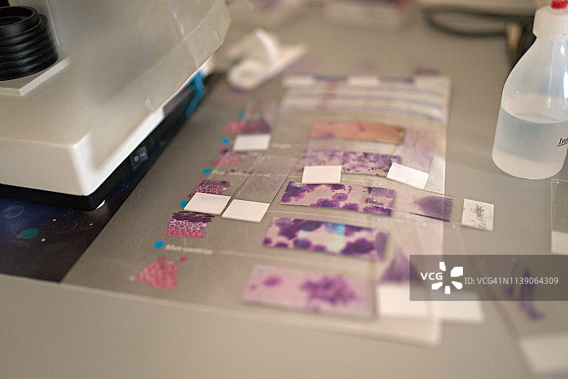 血涂片技术，血液学涂片的血细胞计数图片素材