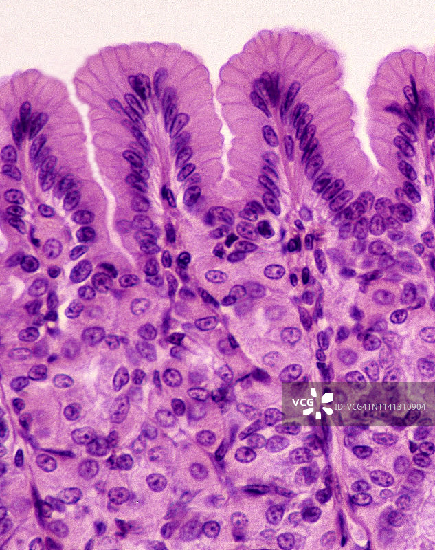 胃粘膜柱状上皮细胞，100倍放大图片素材