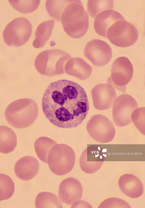 嗜菌白细胞（中性粒细胞），正常人血涂片，500倍图片素材
