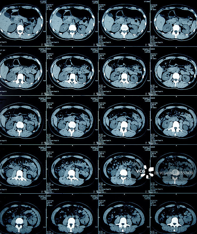 大脑X光片图片素材