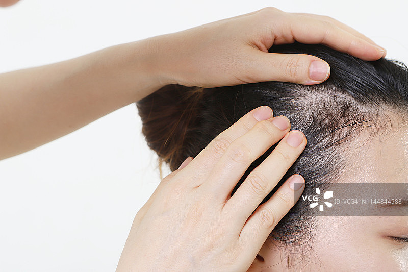 医生检查病人的头皮图片素材