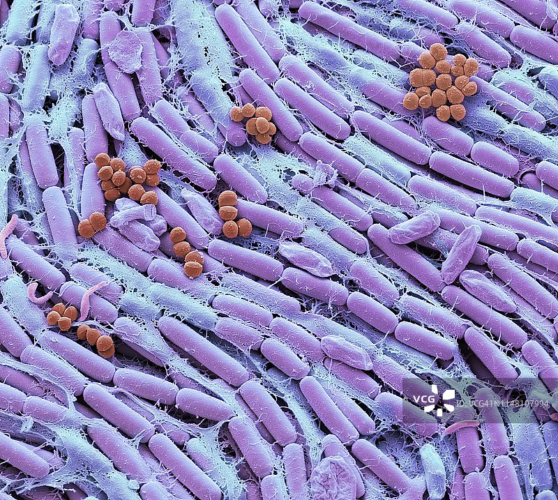 母乳细菌扫描电镜图图片素材