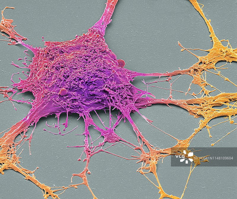 神经元扫描电镜图图片素材