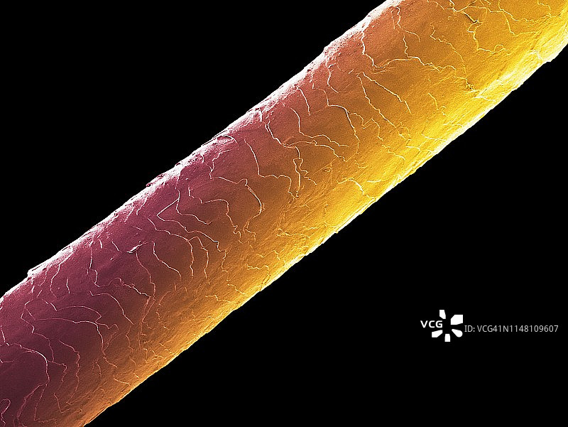 人类头发扫描电镜图片素材