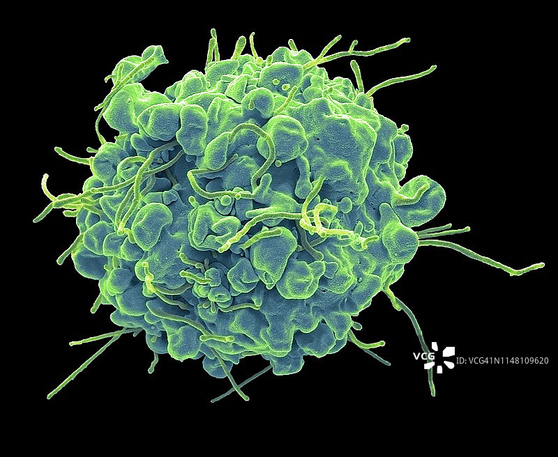 细胞凋亡扫描电镜图图片素材