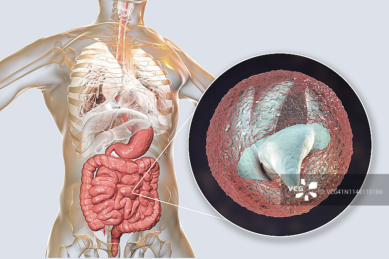 隐孢子虫原生动物肠道寄生虫插图图片素材