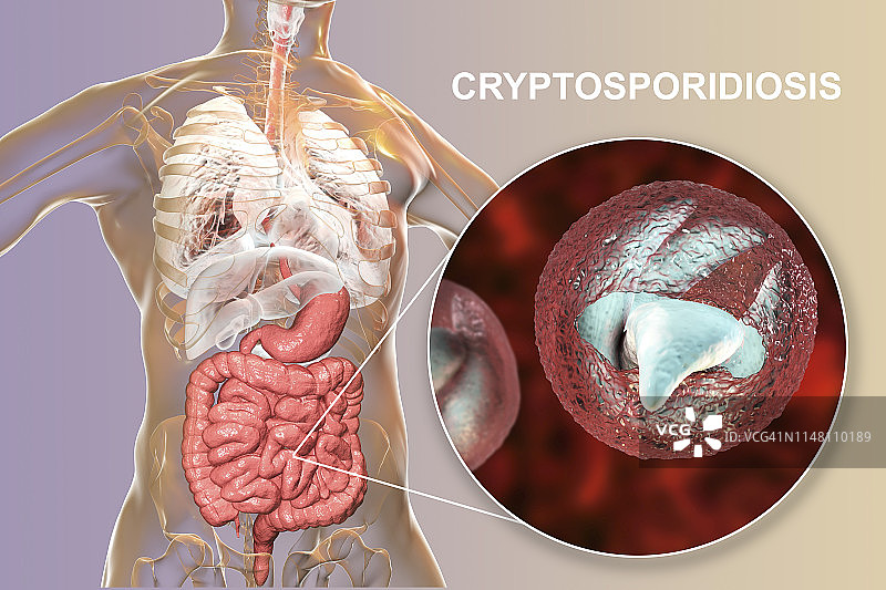 隐孢子虫原生动物肠道寄生虫插图图片素材