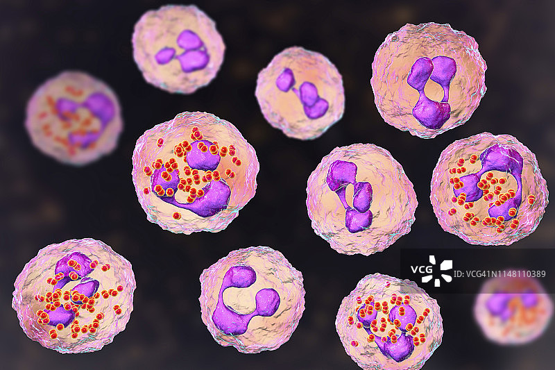 流行性脑脊髓膜炎，图示图片素材
