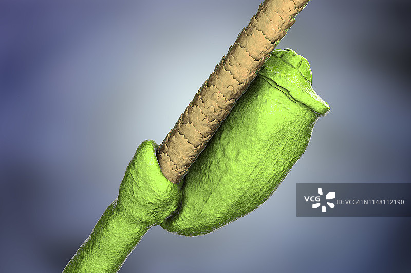 头虱卵插画图片素材