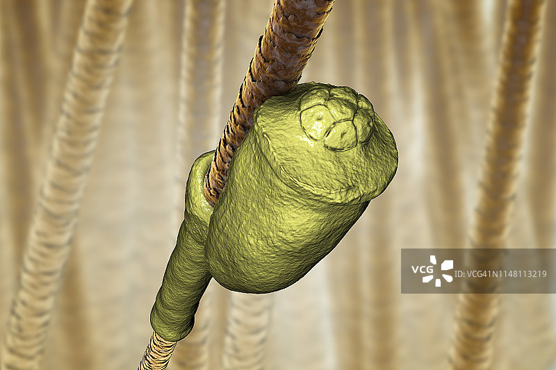 头虱卵插画图片素材