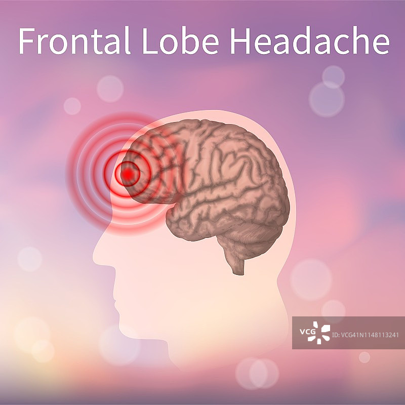 额叶头痛插图图片素材