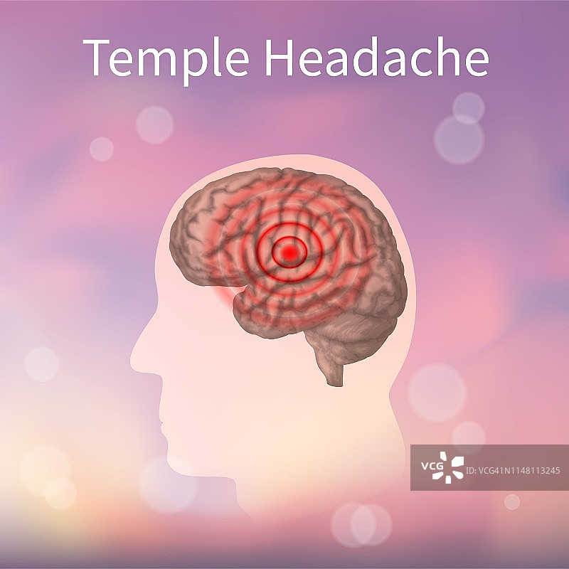 神庙头痛插画图片素材