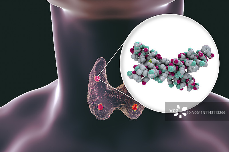 甲状旁腺和甲状旁腺激素，图示图片素材