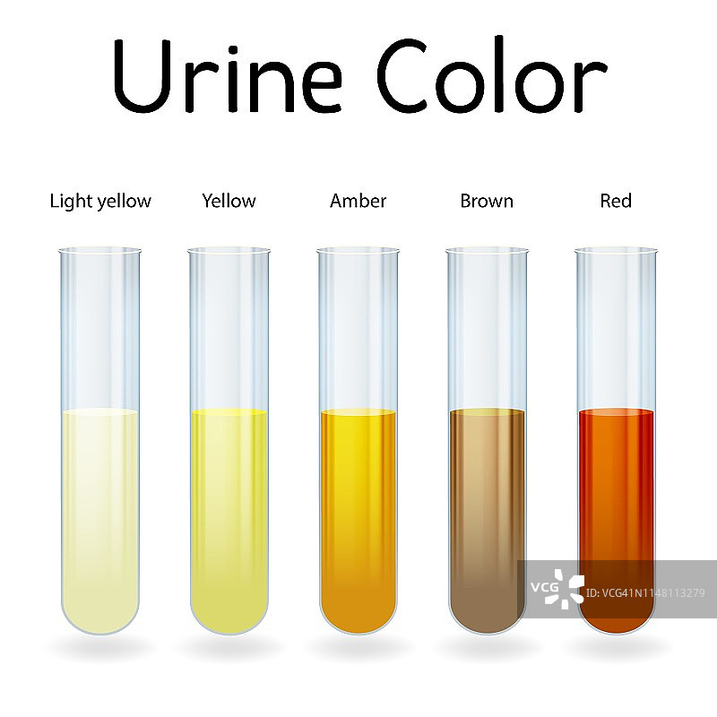 尿液颜色示意图片素材