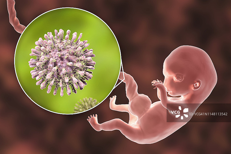艾滋病毒感染人类胚胎，图示图片素材