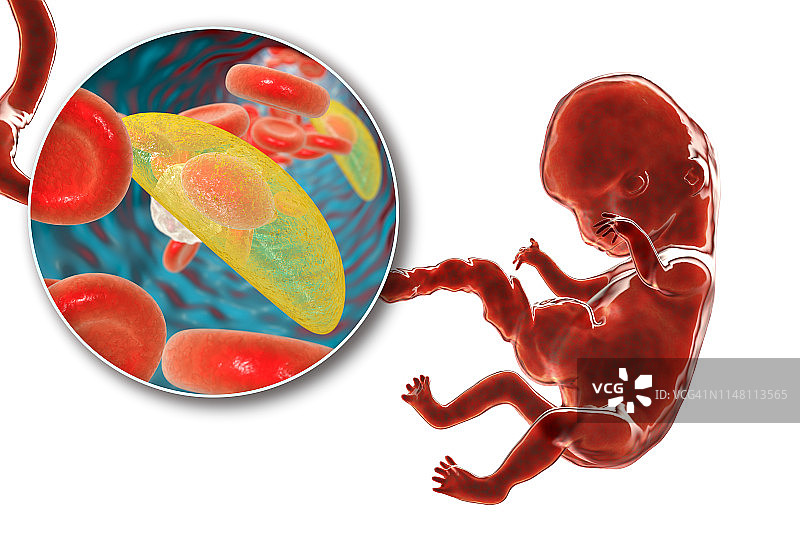 弓形虫病的胎盘传播示意图图片素材