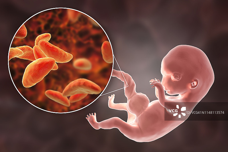 弓形虫病的胎盘传播示意图图片素材