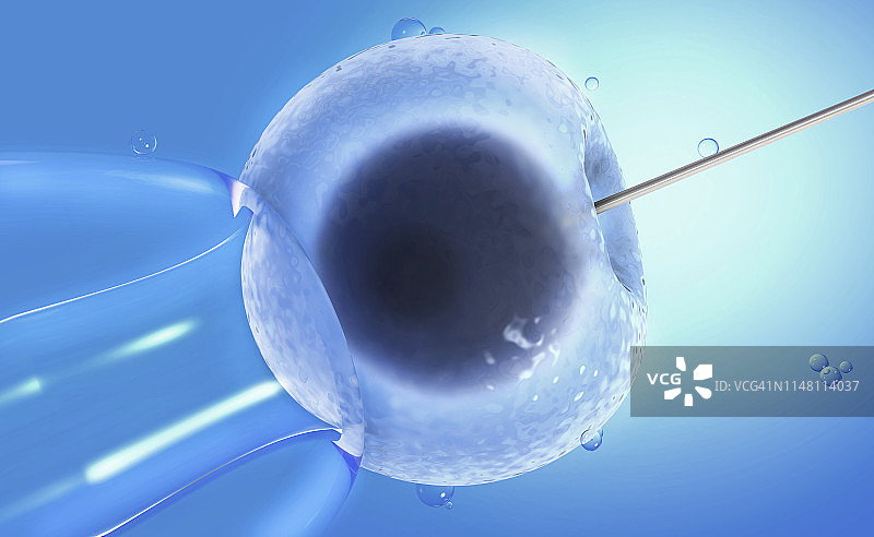 试管婴儿，图示图片素材