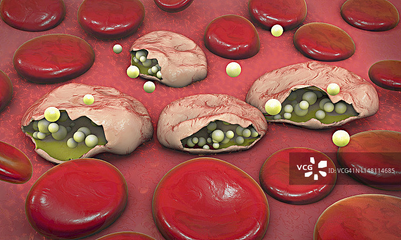 疟疾插图图片素材