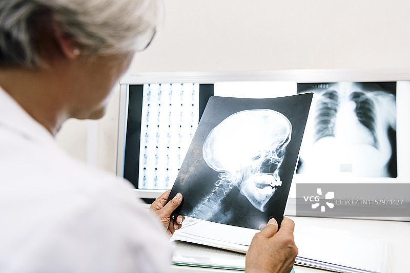 医生查看头骨X光片图片素材