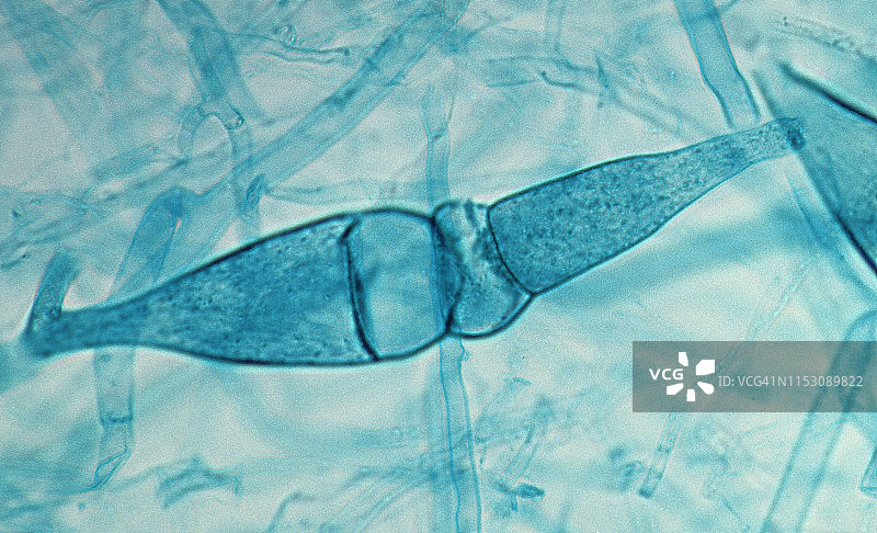黑面包霉菌（Phizopus stolonifer）有性生殖，配子和幼小接合孢子，100倍图片素材