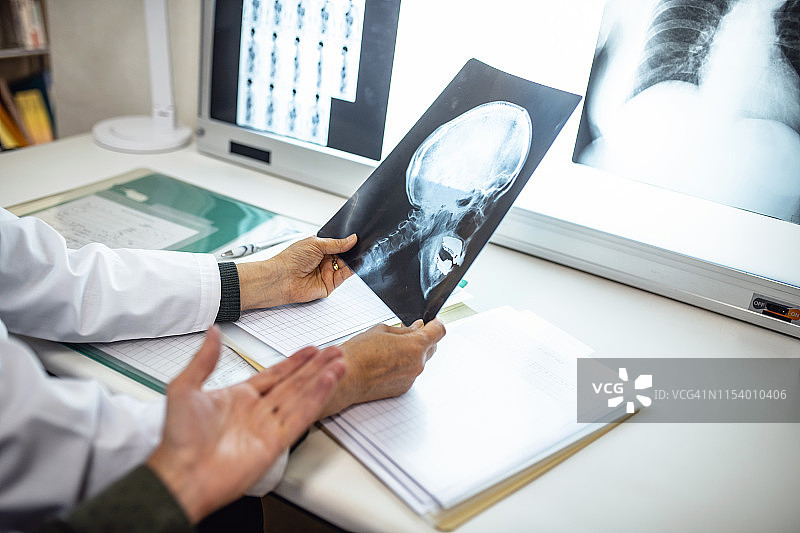 年长的日本女医生研究X光片图片素材