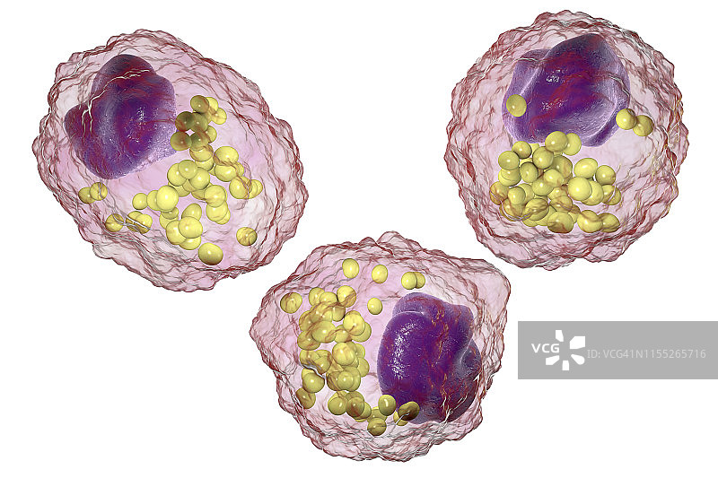 巨噬细胞泡沫细胞插画图片素材
