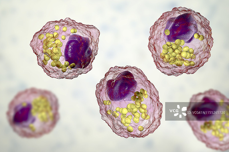 巨噬细胞泡沫细胞插画图片素材