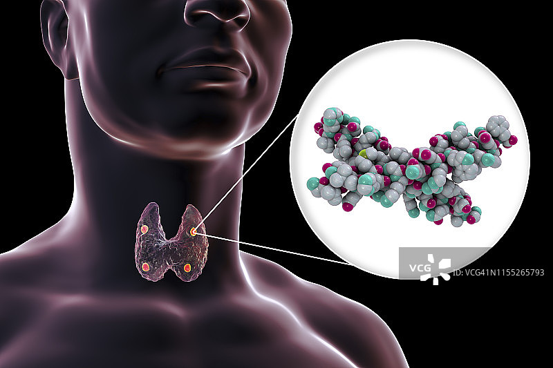 甲状旁腺和甲状旁腺激素，图示图片素材