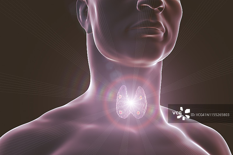 甲状旁腺图示图片素材