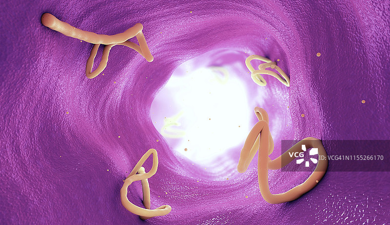 人肠道内的绦虫感染插图图片素材