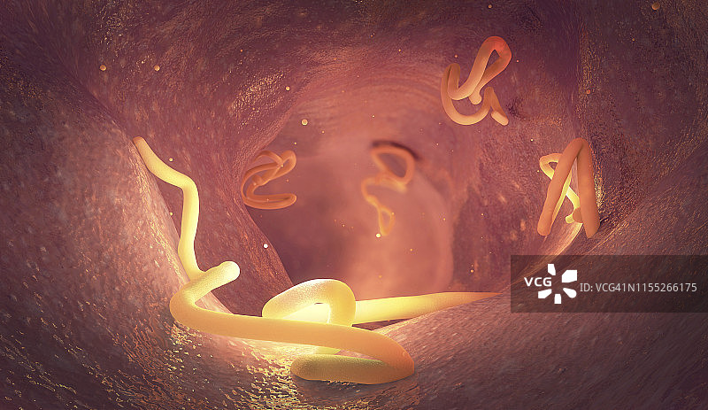 人肠道内的绦虫感染插图图片素材
