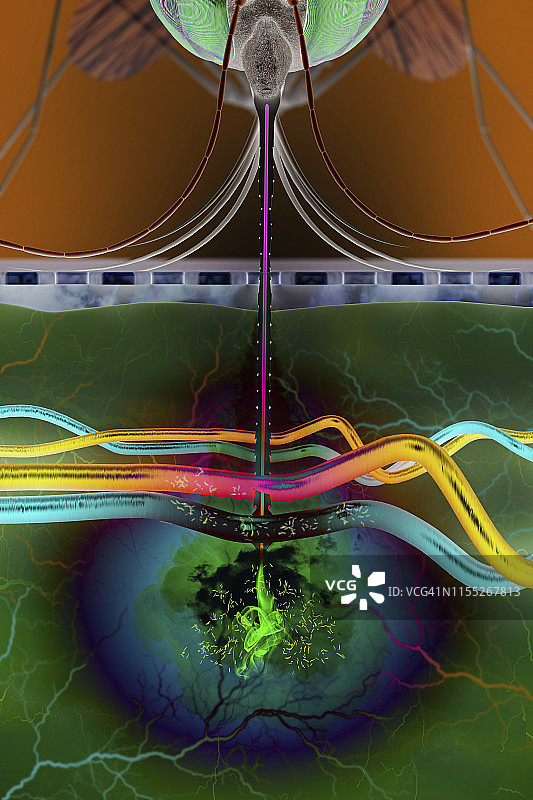 疟疾传播示意图图片素材